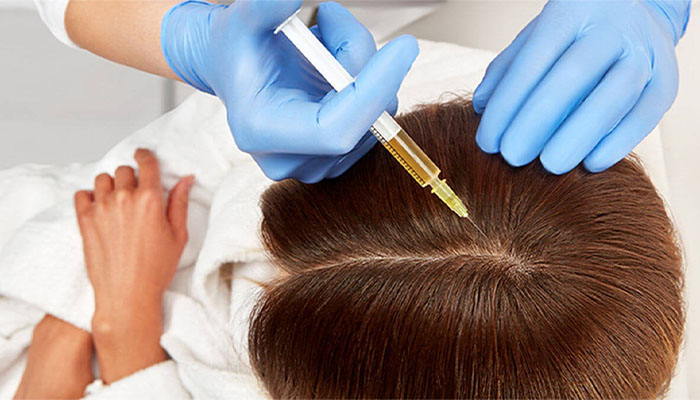 مراقبت های بعد از مزوتراپی