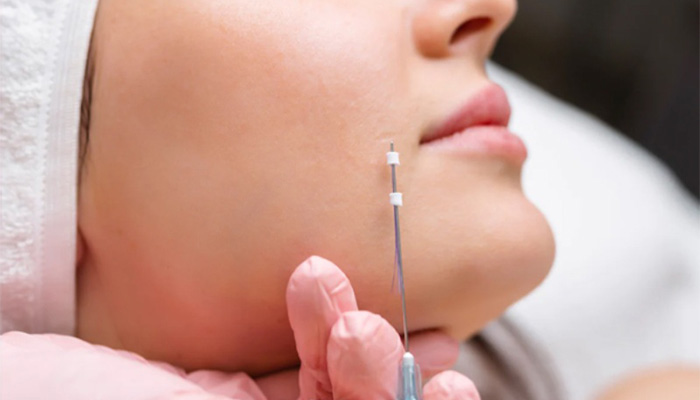 علائم پاره شدن نخ لیفت صورت