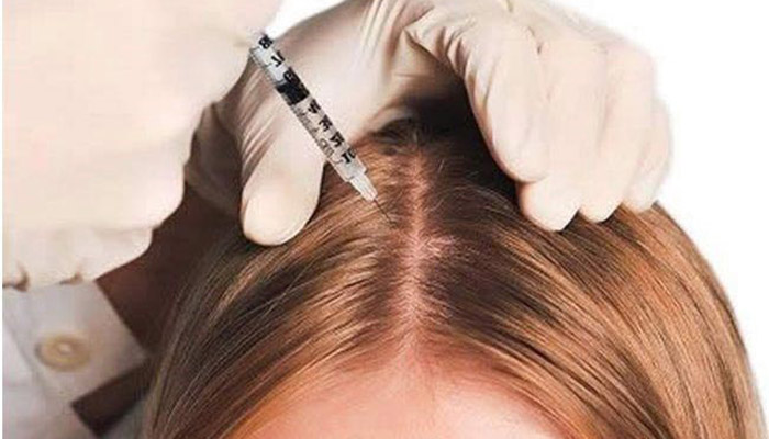 عوارض مزوتراپی مو