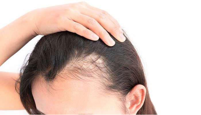 راه های پیشگیری ریزش مو