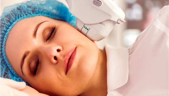 لیفت و جوانسازی صورت با هایفو