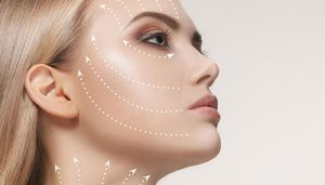 انواع لیفت صورت