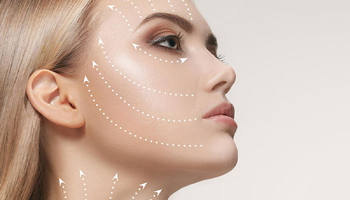 انواع لیفت صورت