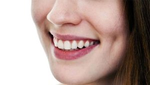 چال گونه با نخ یا با جراحی