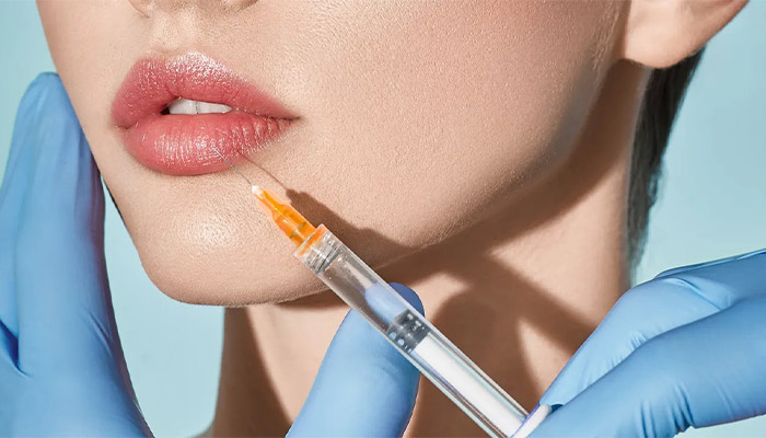 تزریق ژل لب مدل غنچه ای