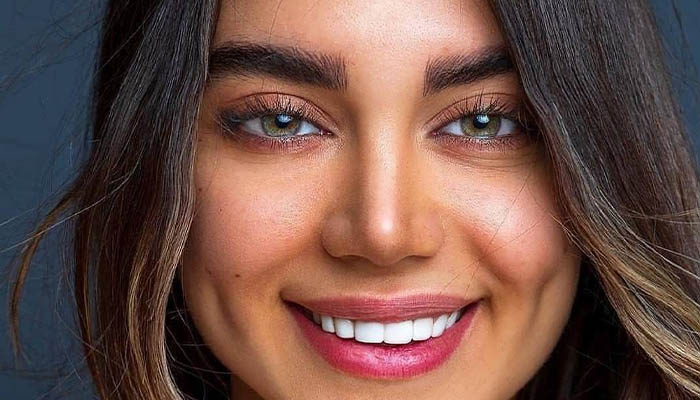 چال گونه با نخ یا با جراحی