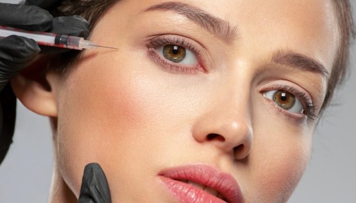 انواع فیلر زیر چشم