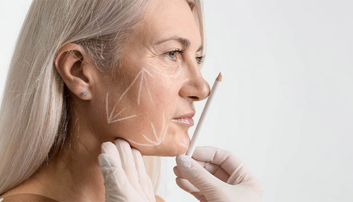 عوارض جراحی لیفت صورت