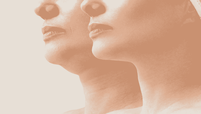 ورزش برای رفع غبغب