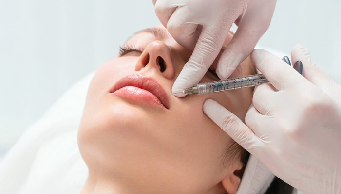 تزریق ژل لب مدل باربی