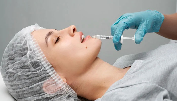 تزریق ژل لب مدل باربی