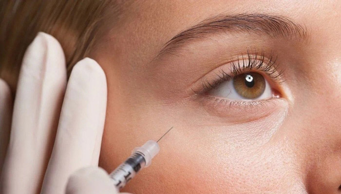 کاربرد های فیلر چشم چیست؟