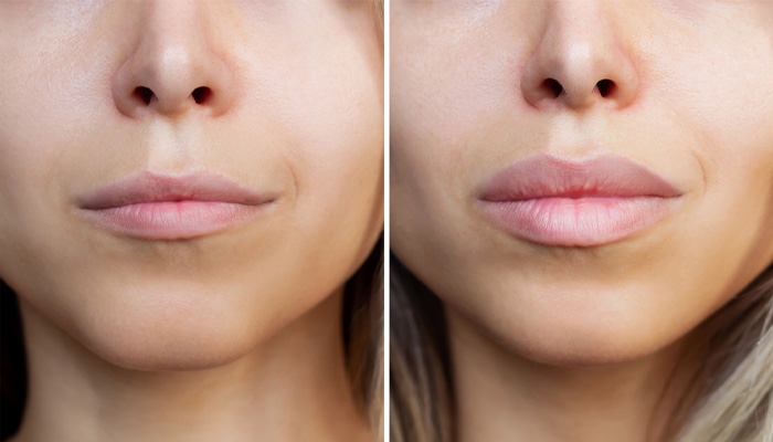 بررسی روش های فرم دهی لب در خانه