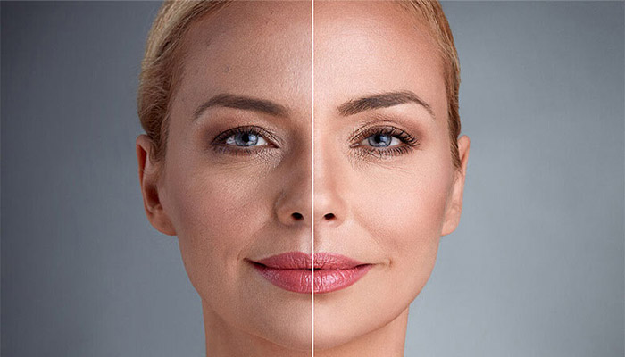 بهترین روش جوانسازی پوست