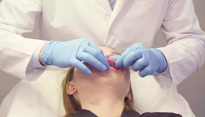 طریقه ماساژ لب بعد از تزریق ژل