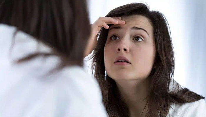 رفع چین و چروک های پیشانی