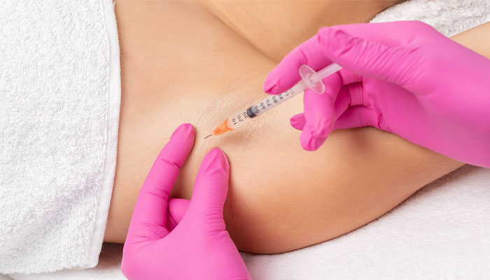 مزایای بوتاکس زیر بغل