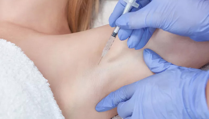 مزایای بوتاکس زیر بغل