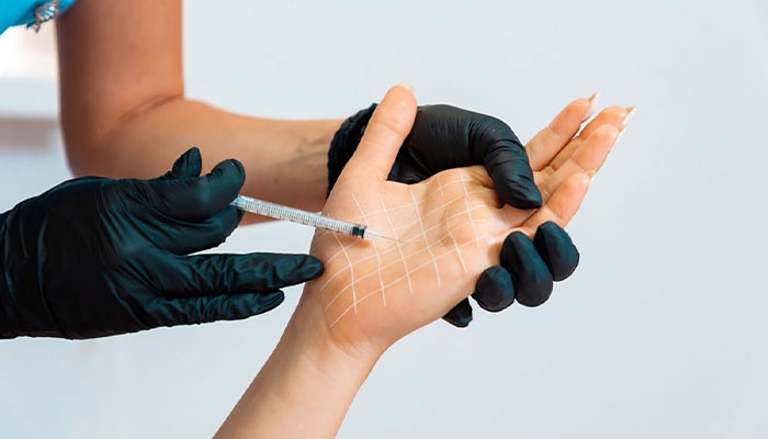 مزایای بوتاکس کف دست