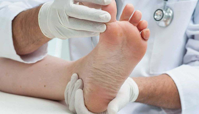 مزایای بوتاکس کف پا