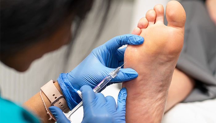 مزایای بوتاکس کف پا