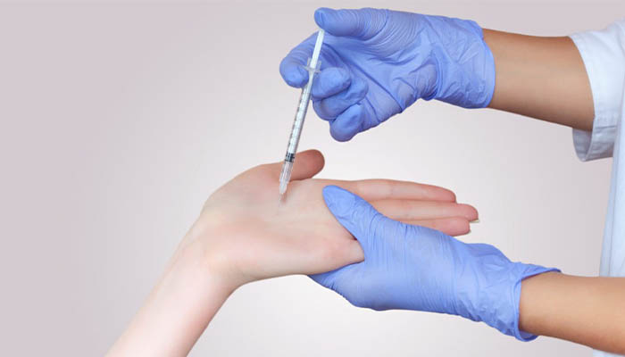 هزینه بوتاکس کف دست و پا