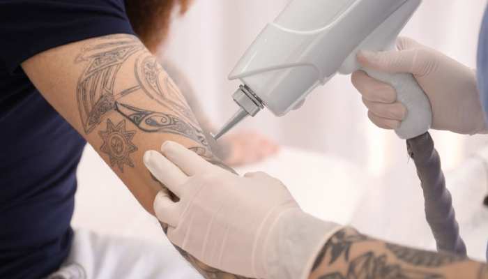 آموزش لیزر تاتو با نازل ترین قیمت