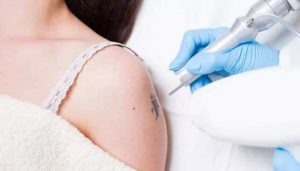 آموزش لیزر تاتو با نازل ترین قیمت