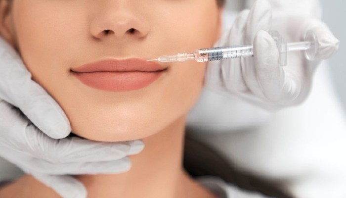 تزریق ژل لب مدل صدفی