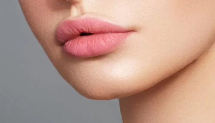 تزریق ژل لب مدل صدفی