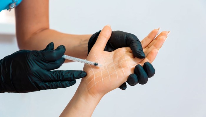 عوارض بوتاکس کف دست و پا