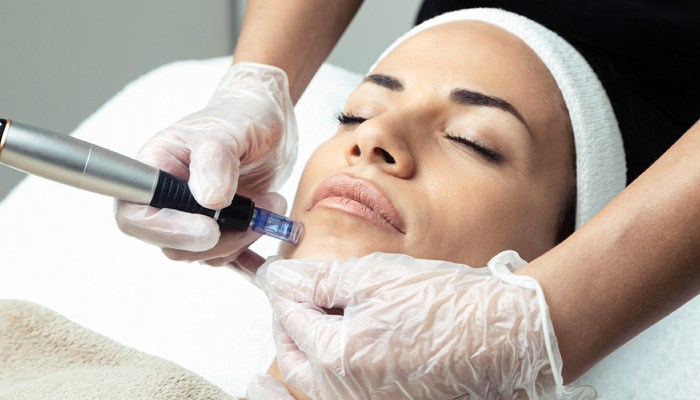 فواید میکرونیدلینگ برای جوانسازی پوست