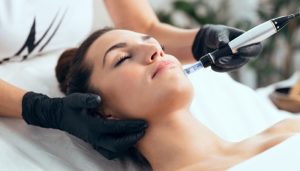 فواید میکرونیدلینگ برای جوانسازی پوست