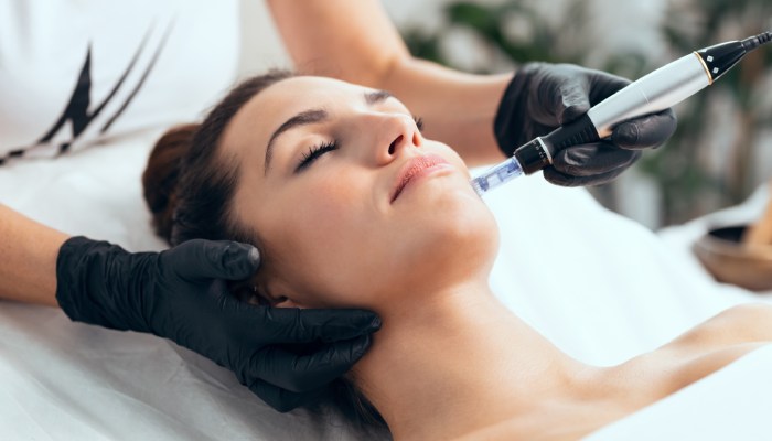 فواید میکرونیدلینگ برای جوانسازی پوست