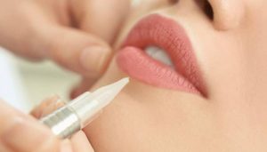 پاک کردن تاتو خط لب با لیزر