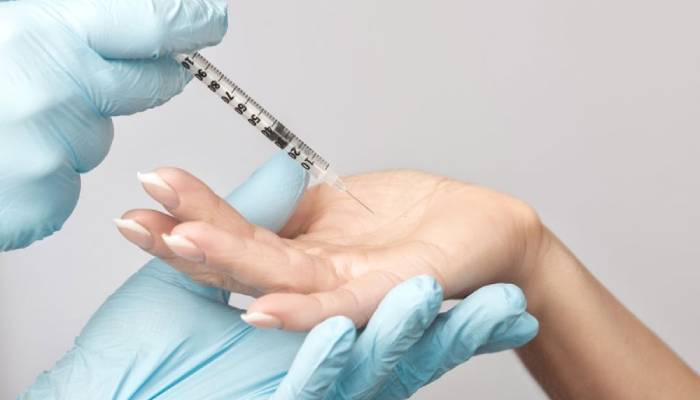 بهترین مرکز بوتاکس کف دست و پا