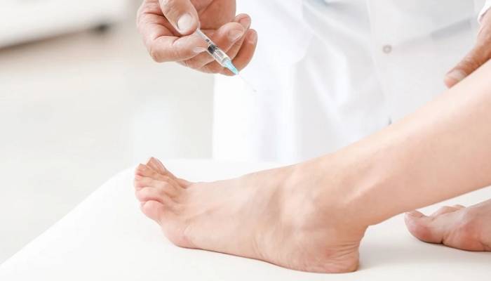 بهترین مرکز بوتاکس کف دست و پا