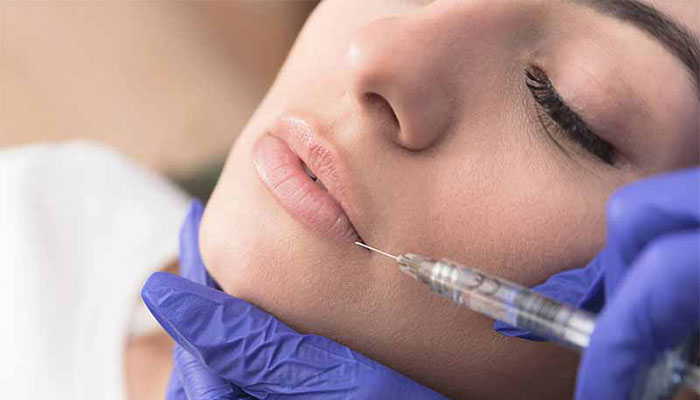 اشتباهات رایج بعد از تزریق فیلر