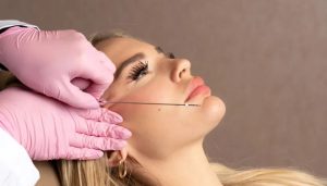 بهترین روش لیفت صورت برای سنین بالا