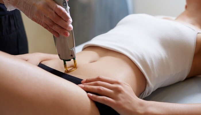 عوارض لیزر موهای زائو بیکینی