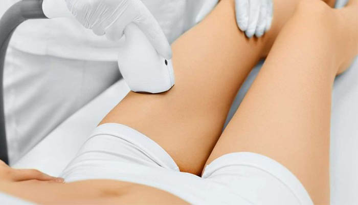 لیزر موهای زائد بیکینی