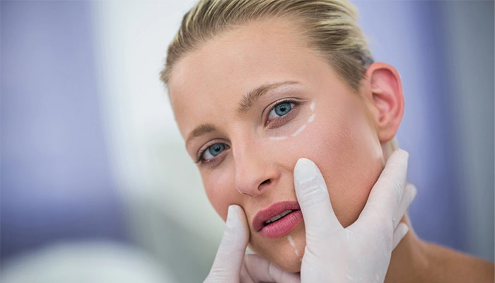 نحوه درمان لک صورت