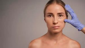 اقدامات قبل از بوتاکس