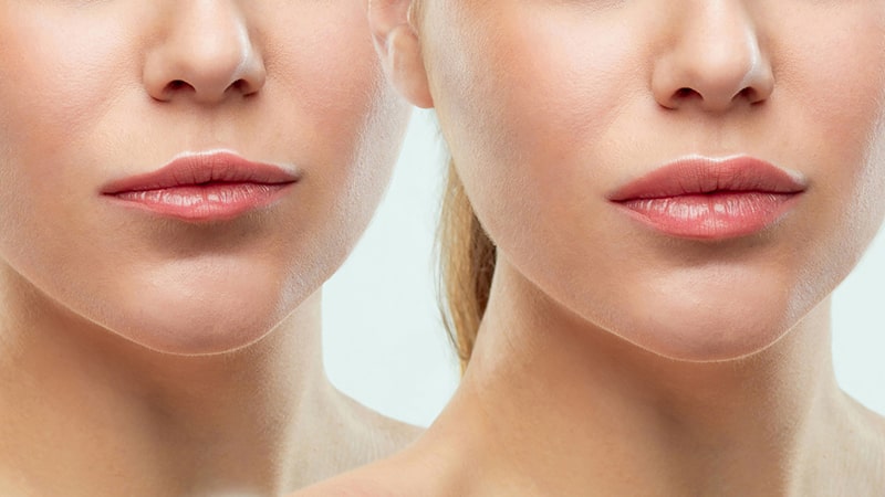 نتایج قابل بازگشت