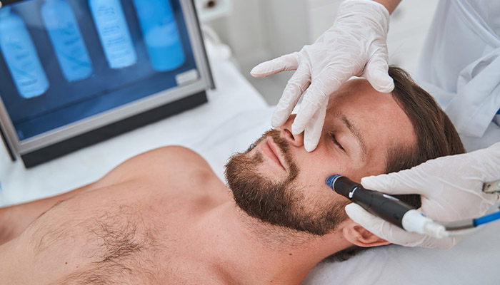 انجام فیشیال پوست برای مردان