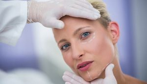 زاویه سازی صورت با تزریق ژل