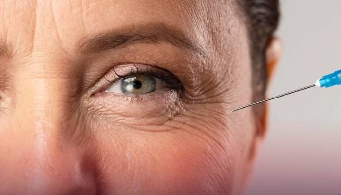 عوارض فیلر زیر چشم