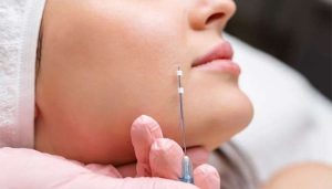 لیفت صورت بدون جراحی