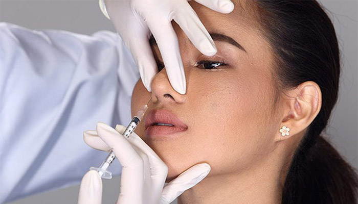 ماندگاری فیلر